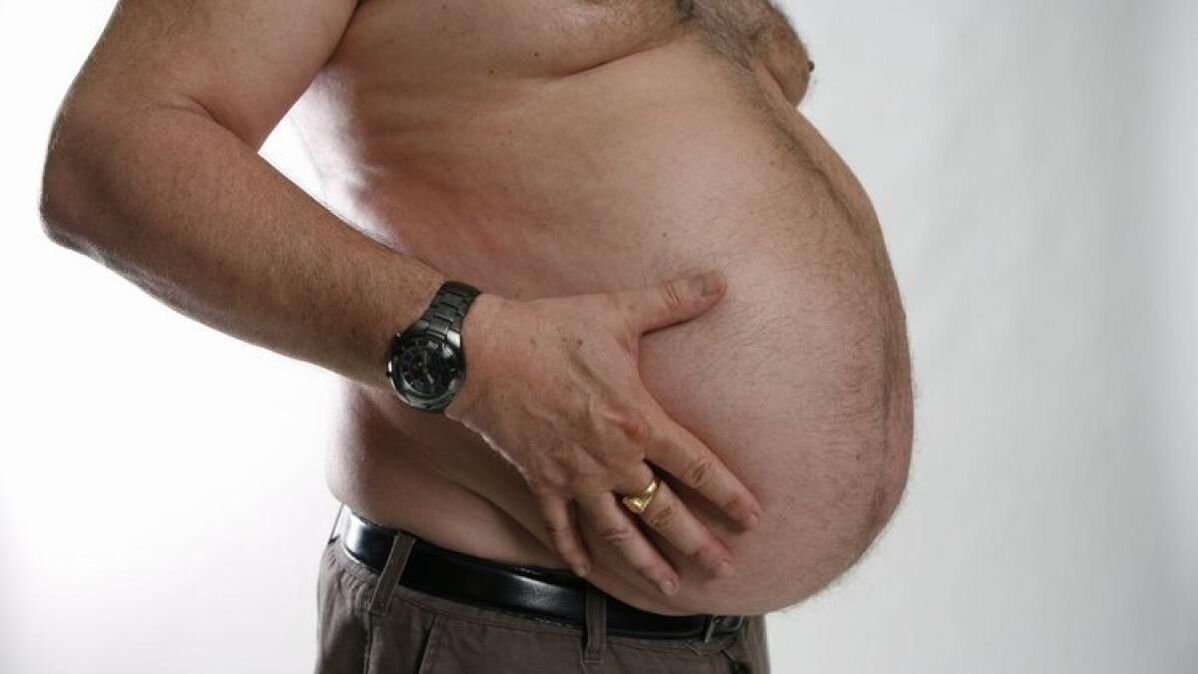 дебелината како причина за развој на проширени вени