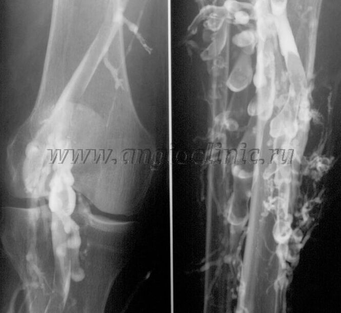 Ултразвучно скенирање